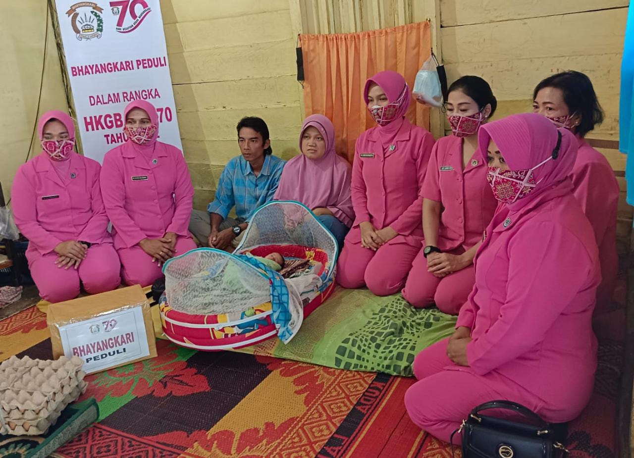 Ketua Bhayangkari Cabang Sidempuan Beri Tali Asih ke Bayi Penderita Omfalokel